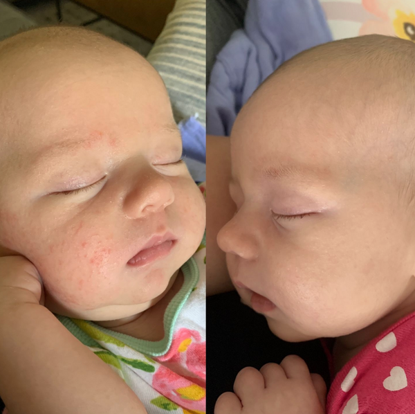 baby before and after 